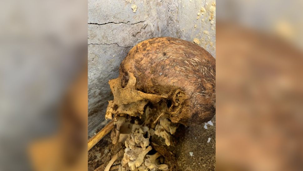 Uma visão de perto dos restos mumificados de Marcus Venerius Secundio. Embora o corpo tenha quase 2.000 anos, pedaços de cabelo e uma orelha ainda são visíveis no crânio. Os restos mortais foram levados para um laboratório para que os pesquisadores possam saber mais sobre se essa mumificação foi intencional.